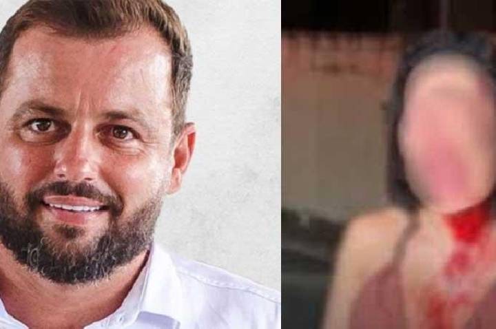 Vereador do PL não aceita 'fora' e agride mulher com garrafada na cabeça: 