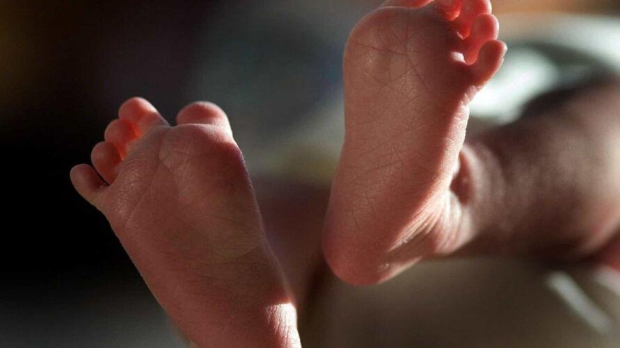 BEBÊ NASCE COM TRÊS PÊNIS