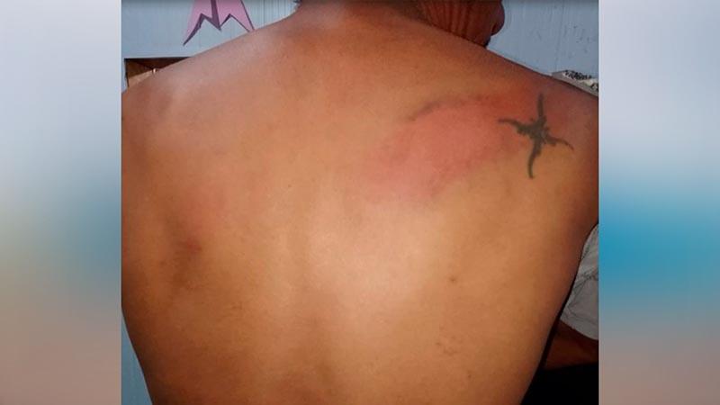 Pistoleiros invadem acampamento e atacam famílias no Pará