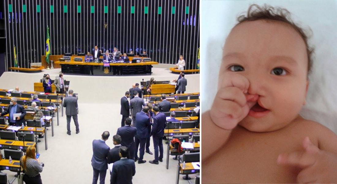 Dia Nacional de Conscientização sobre a Fissura Labiopalatina é aprovado no Senado Federal