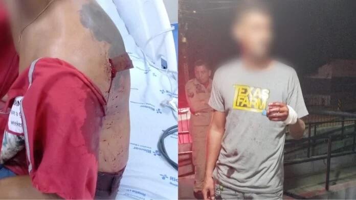 Homem esfaqueado fica com faca cravada na costa em Itaituba, no Pará