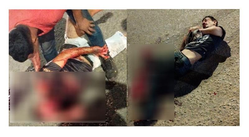 Colisão entre motos deixa duas pessoas feridas em Santarém