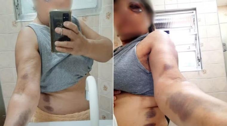 Professora é agredida por aluno de 15 anos após ele ser expulso da sala de aula