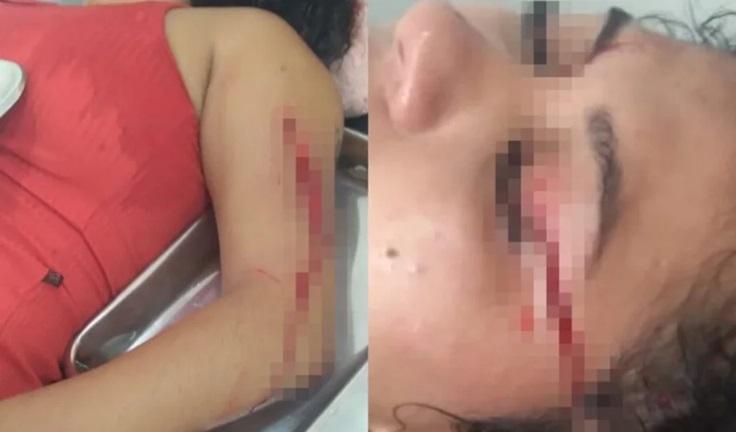 Mulher é vítima de tentativa de homicídio em garimpo de Itaituba