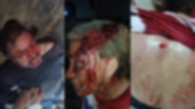 Garimpeiro é morto durante assalto em região garimpeira de Itaituba no Pará